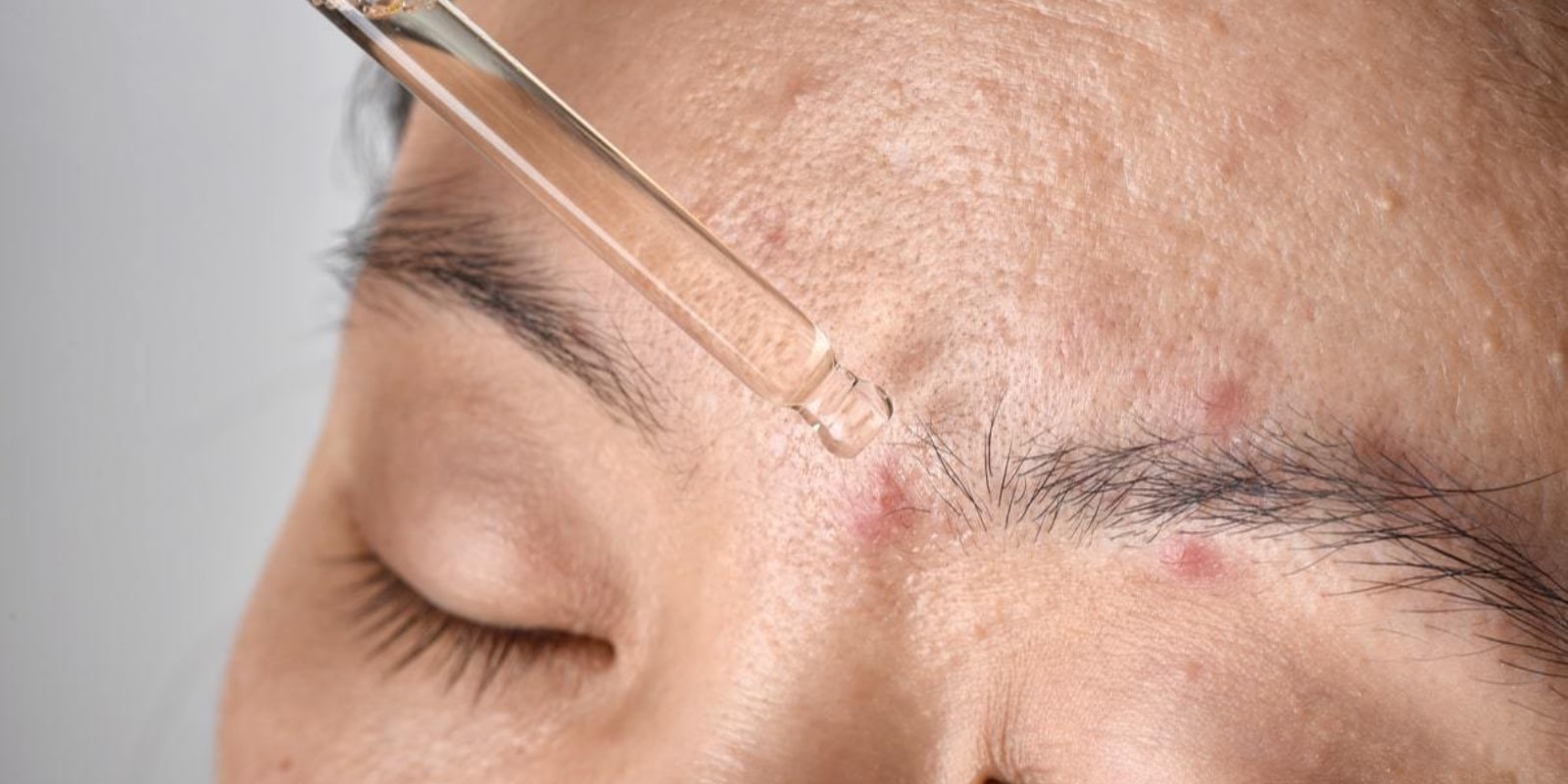 Woman dropping serum onto her skin