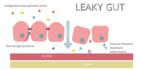 Cartoon of the line-up of cells that lines the GI tract. The left side shows heathy tight junctions that prevent food from exiting the intestines, & the right side shows how when tight junctions break down, foodstuffs, microbes, immune cells, & more are able to leak out into the body where they are taken up by lymph & blood vessels.