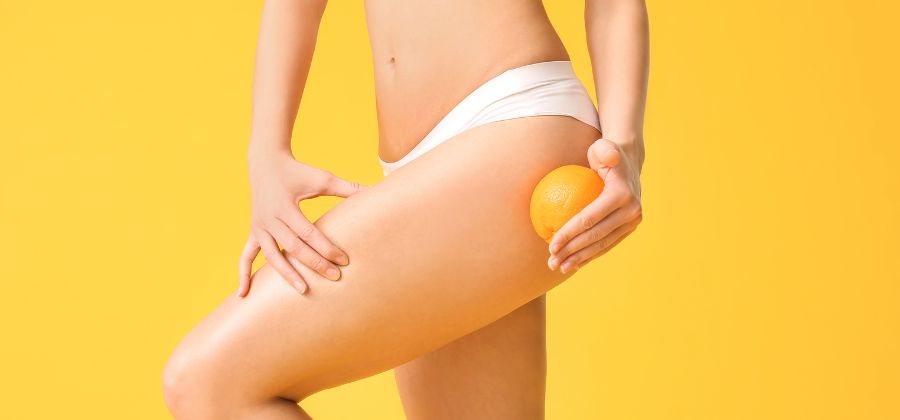 Ventouse cellulite : Avant - Après d'utilisatrices - CalculerSonIMC