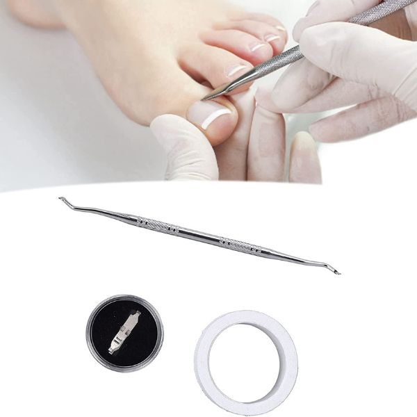 kit pour ongle incarné