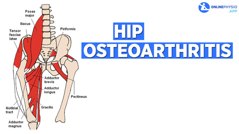 Hip Osteoathritis