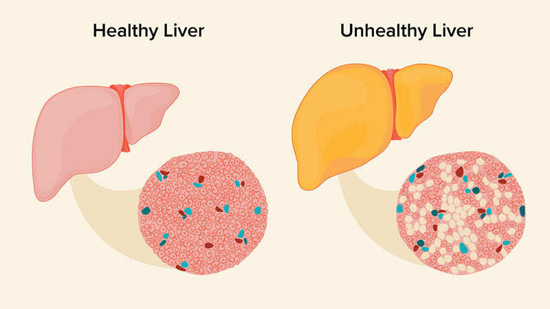 5 Signs You Need A Liver Detox Me First Living   Liver Detox 2048x 