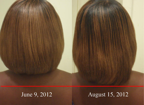 Biotin for Hair Growth