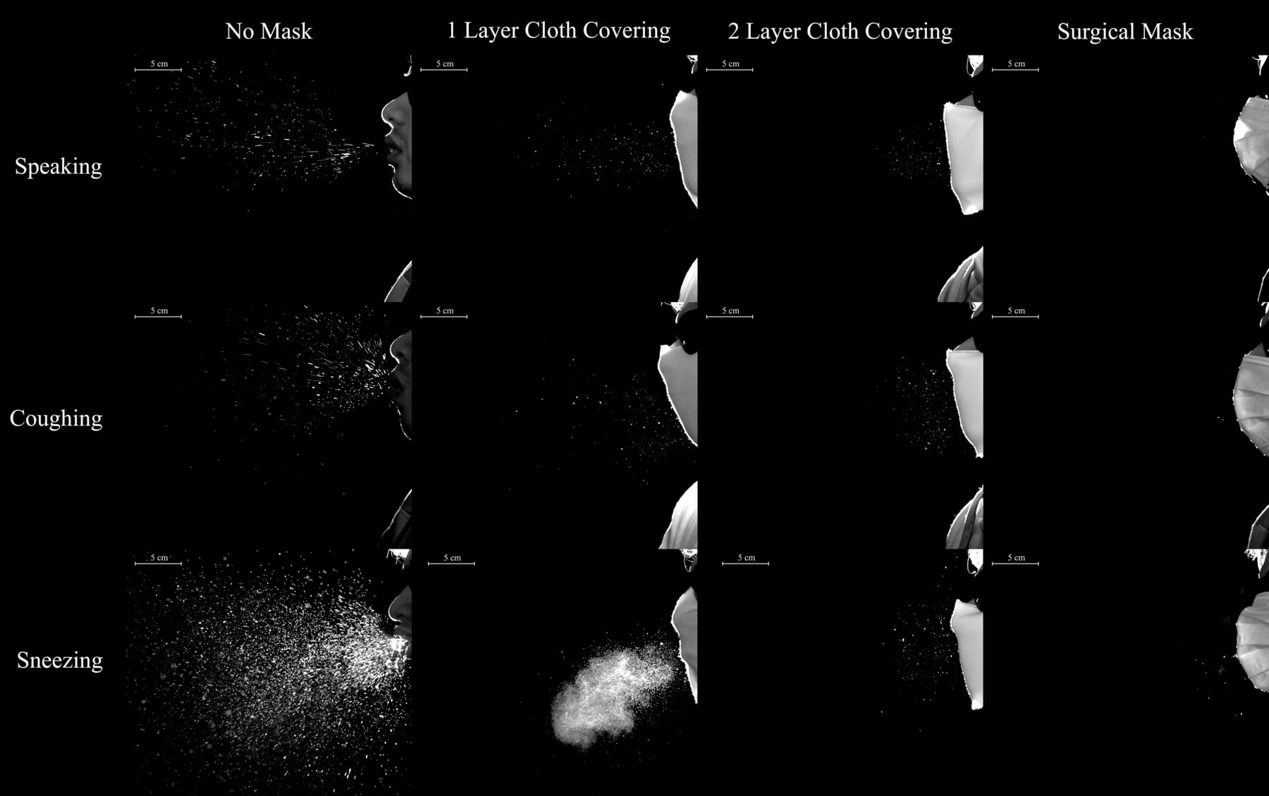 Thorax research shows effectiveness of masks at containing respiratory droplets