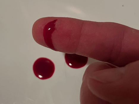 The Accident: blood dripping on the countertop