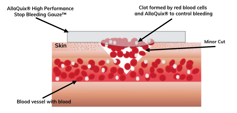 AllaQuix® helps red blood cells form a clot on the surface of the skin to stop minor wounds from bleeding quickly.