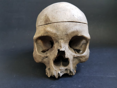 Antique partial real human skull medical specimen