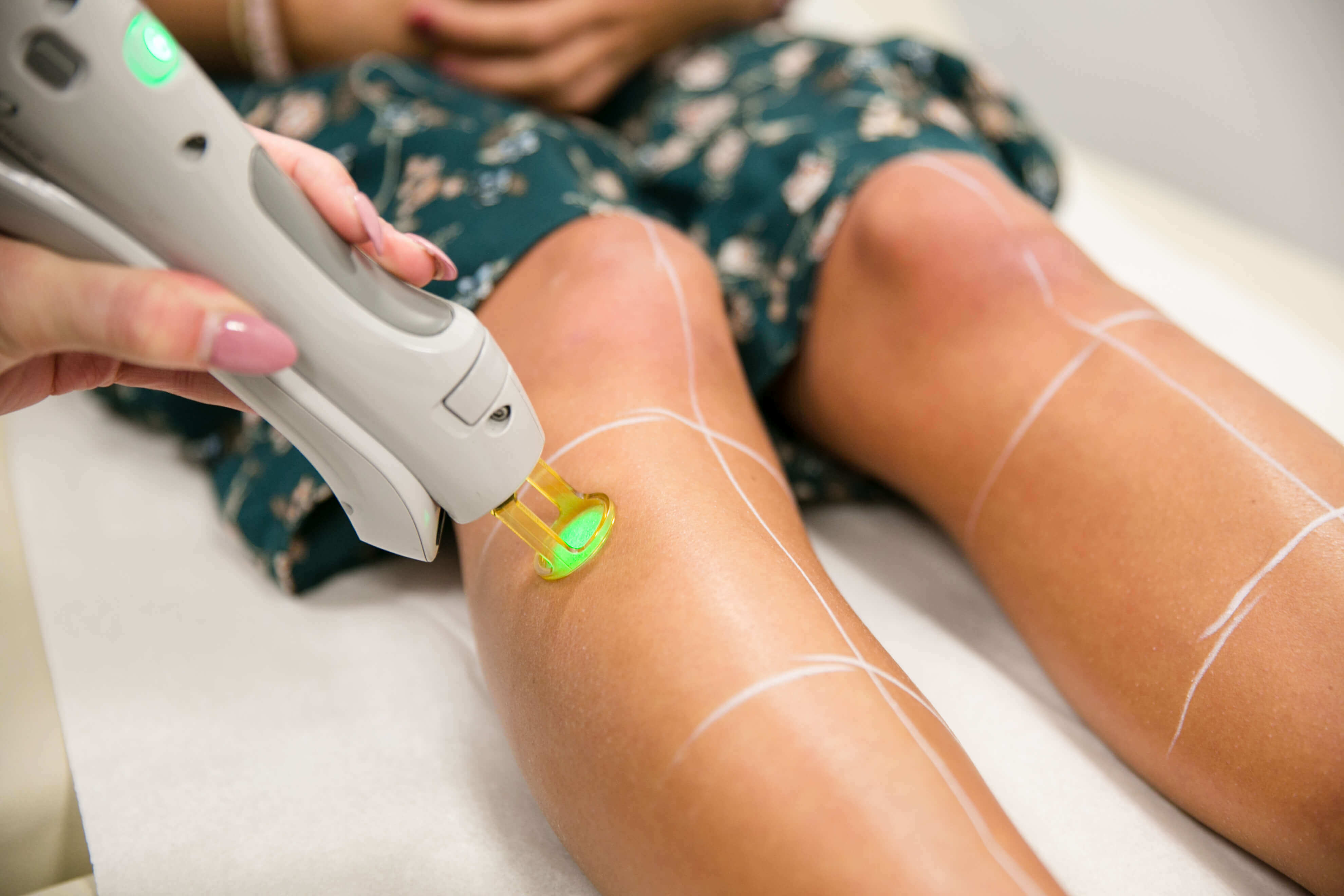 Laser Hair Removal  4 Secretes to Successful Treatments