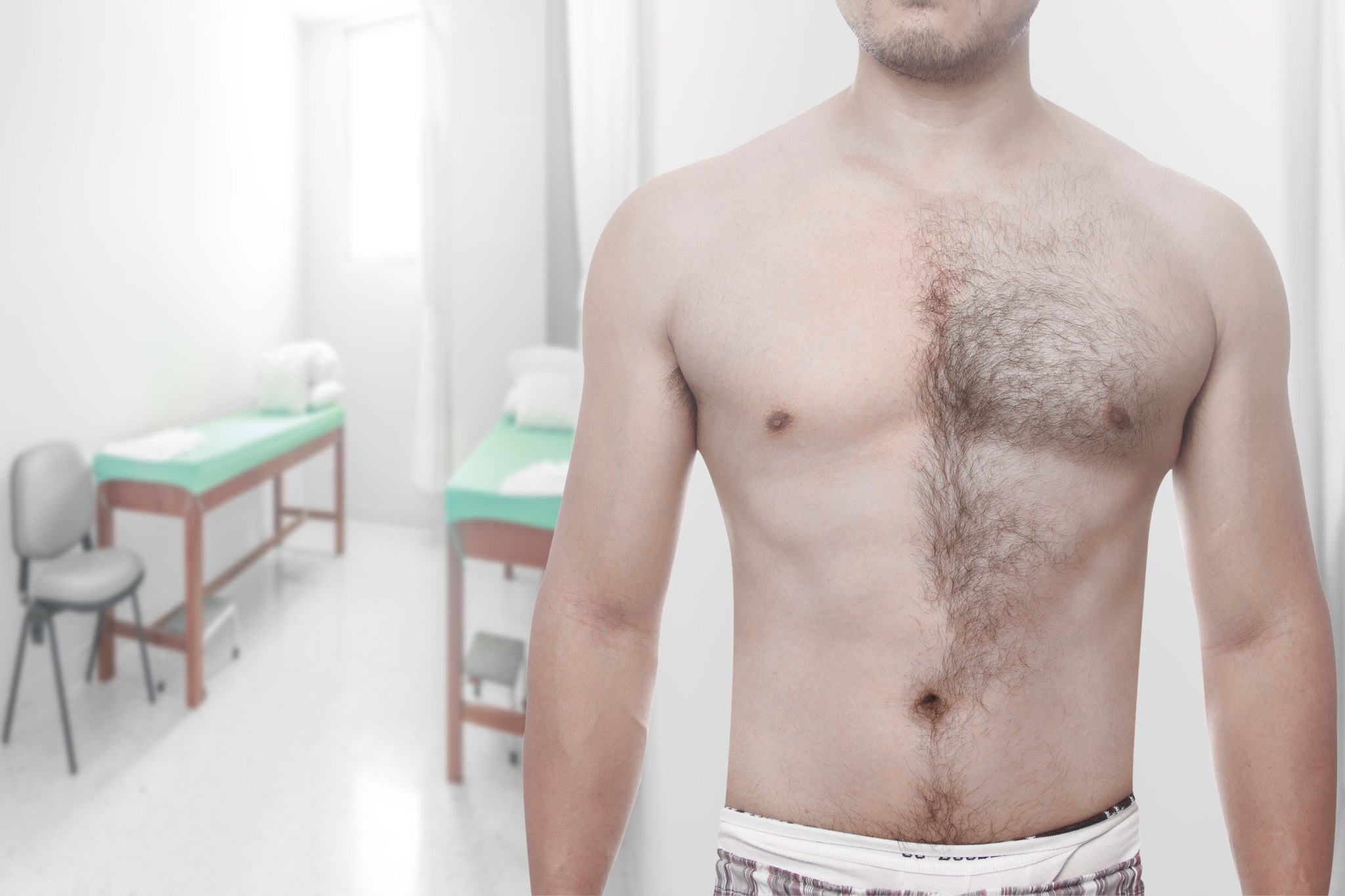 Top 4 most popular areas for men to get laser hair removal