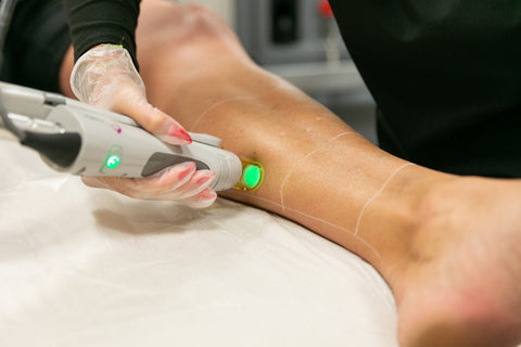 Process Of Laser Hair Removal For Legs By Simplicity Laser