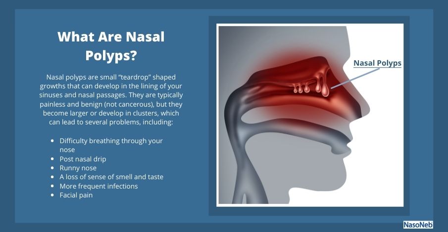 Signs Of Nasal Polyps Georgetown Ear, Nose And Throat Center ...