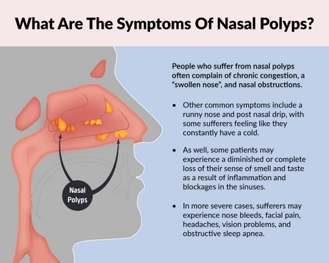 Nasal Polyps: Causes, Symptoms, Treatments, and Prevention