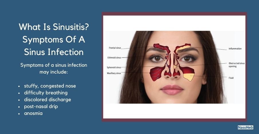 What Are The Symptoms Of A Sinus Infection?