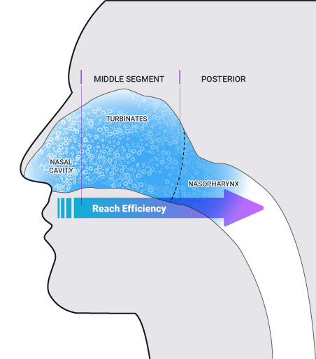 Sinus Therapy System Deposition on the Nasal Cavities