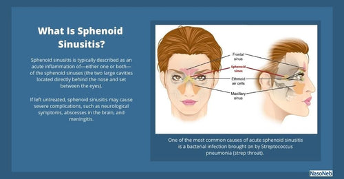 maxillary and ethmoid sinus disease