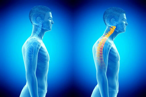 why good posture is important