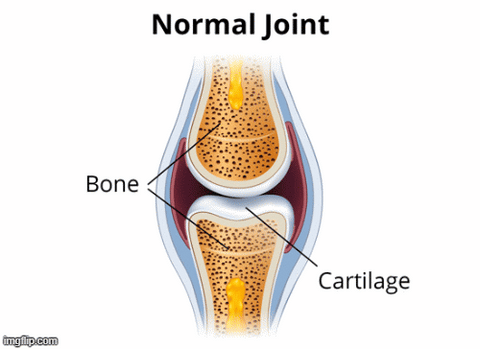 how mrjoint knee relief patches work