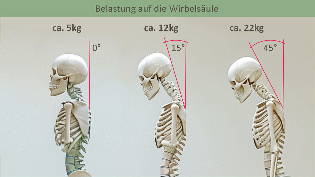 Folgen des Handynackens, biegung bis zu 45 grad winkel