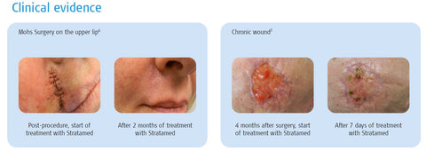 Stratamed Clinical Evidence