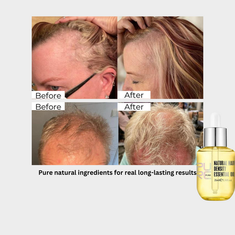 HairReviveX™ Scalp Hair Growth Oil