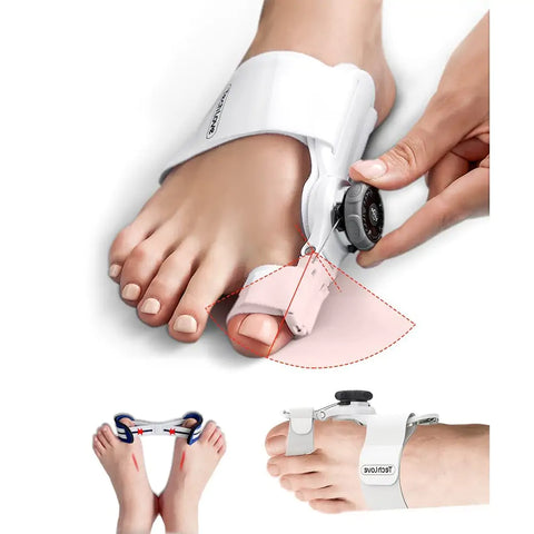 Caretras Bunion Corrector