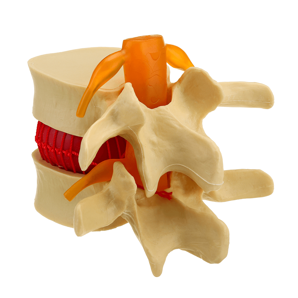 Medical Lumbar Vertebrae Model Props Anatomical Spine Herniation Teach ...