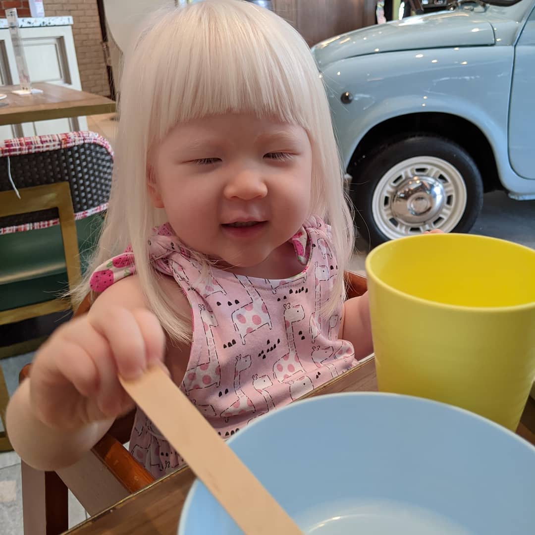 Cotton Pigs | The joys and challenges of raising a child with albinism 3