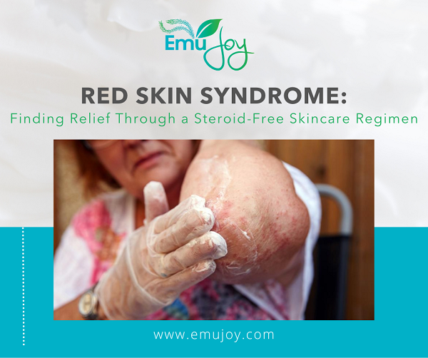 red skin syndrome relief Facebook promo