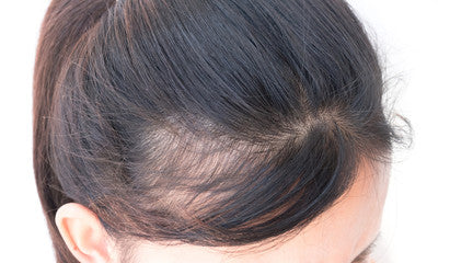 hair loss concerns for women, hair transplant operation