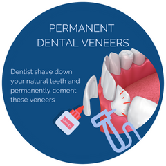 permanent dental Veneers