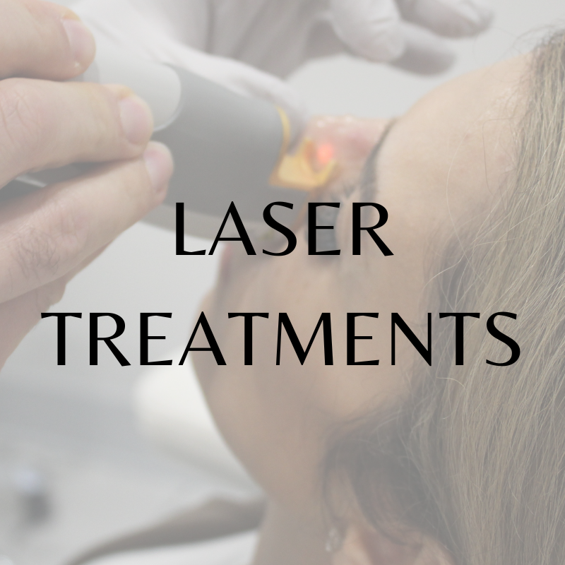 LASER TREATMENT