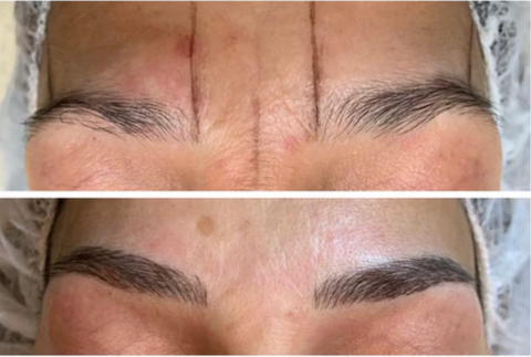 microblading before and after jeunesse medical spa holmdel old bridge nj new jersey