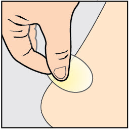 applying a blister treatment hydrocolloid