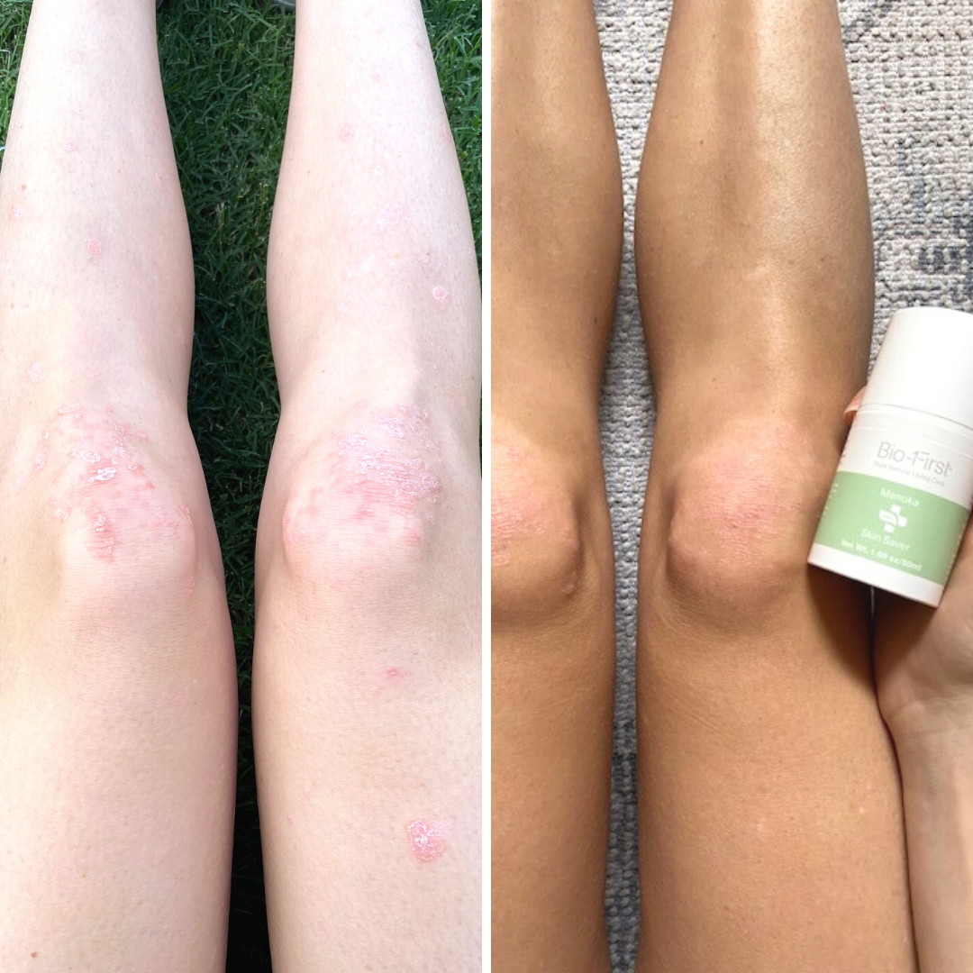 How will it help my skin?