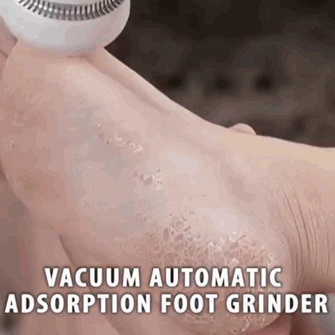 Foot Pedicure Callus Remover – shopnormad