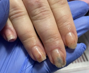 Allergy to gel polish before using trustworthy HONA products