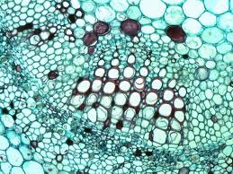 Stained cross section of a cotton stem