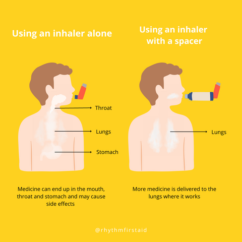 Using an inhaler vs. with a spacer for astham treamtent