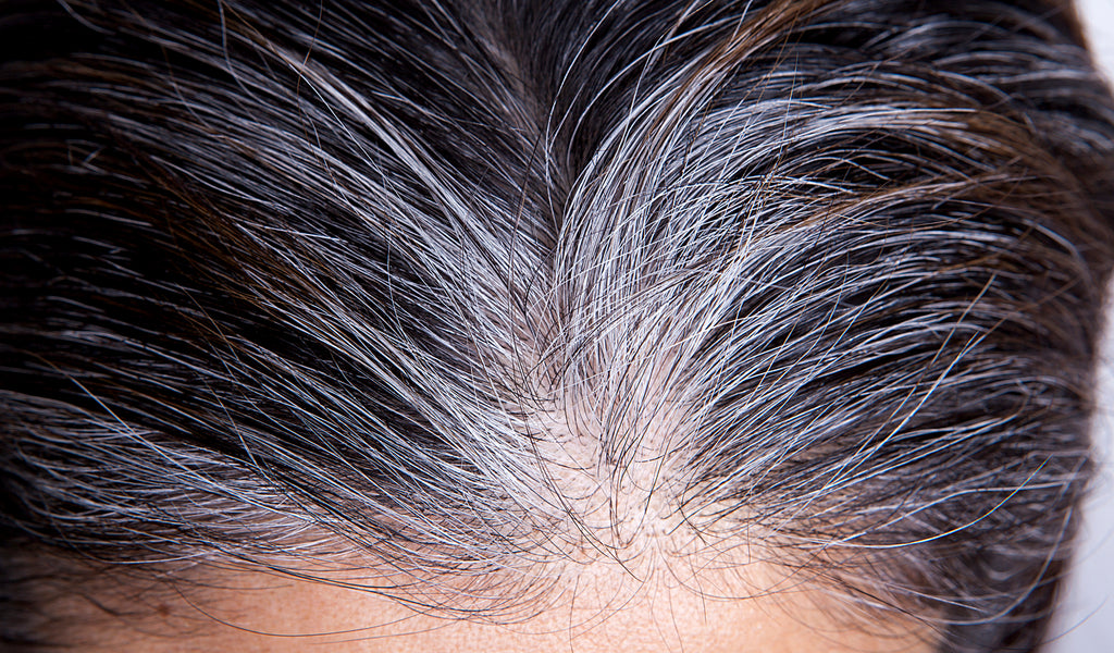 Bild einer Haarwurzel mit grauem Haar