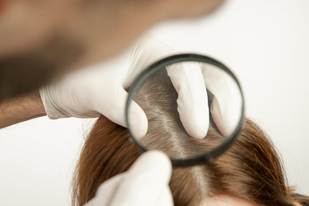 Inspección del cuero cabelludo afectado por picores