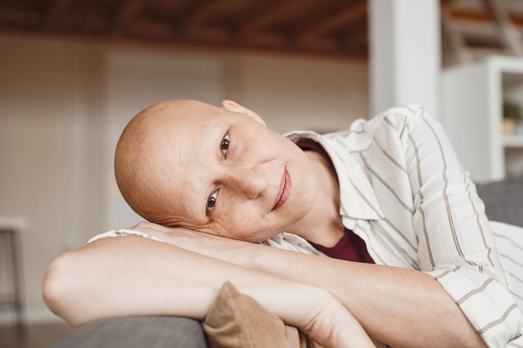 Frau mit Alopezie aufgrund einer Chemotherapie