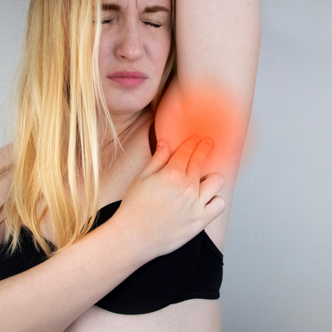 Razor burn and irritation on woman's underarm.