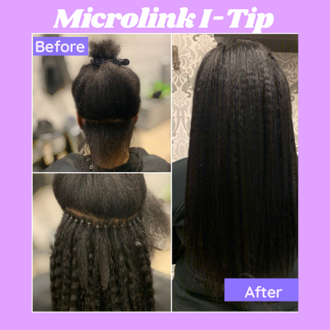 Microlink i-tip appointment service near me