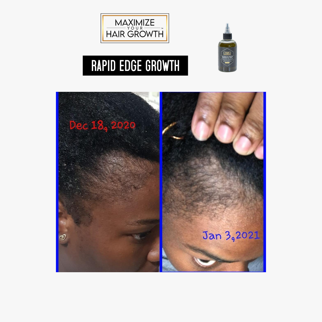 Dr Miracles Hair  Scalp Products