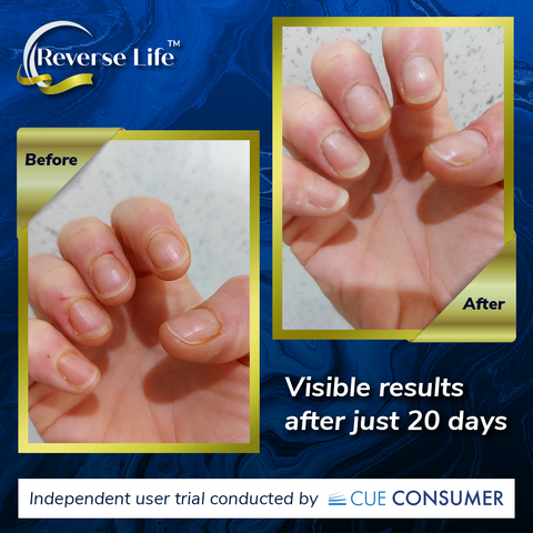 ReverseLife_BlogImage_CollagenBefore&After_NailStrength