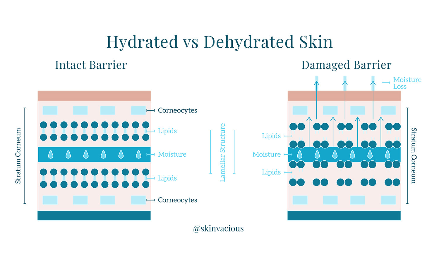 skinVacious - Hydrated vs Dehydrated Skin