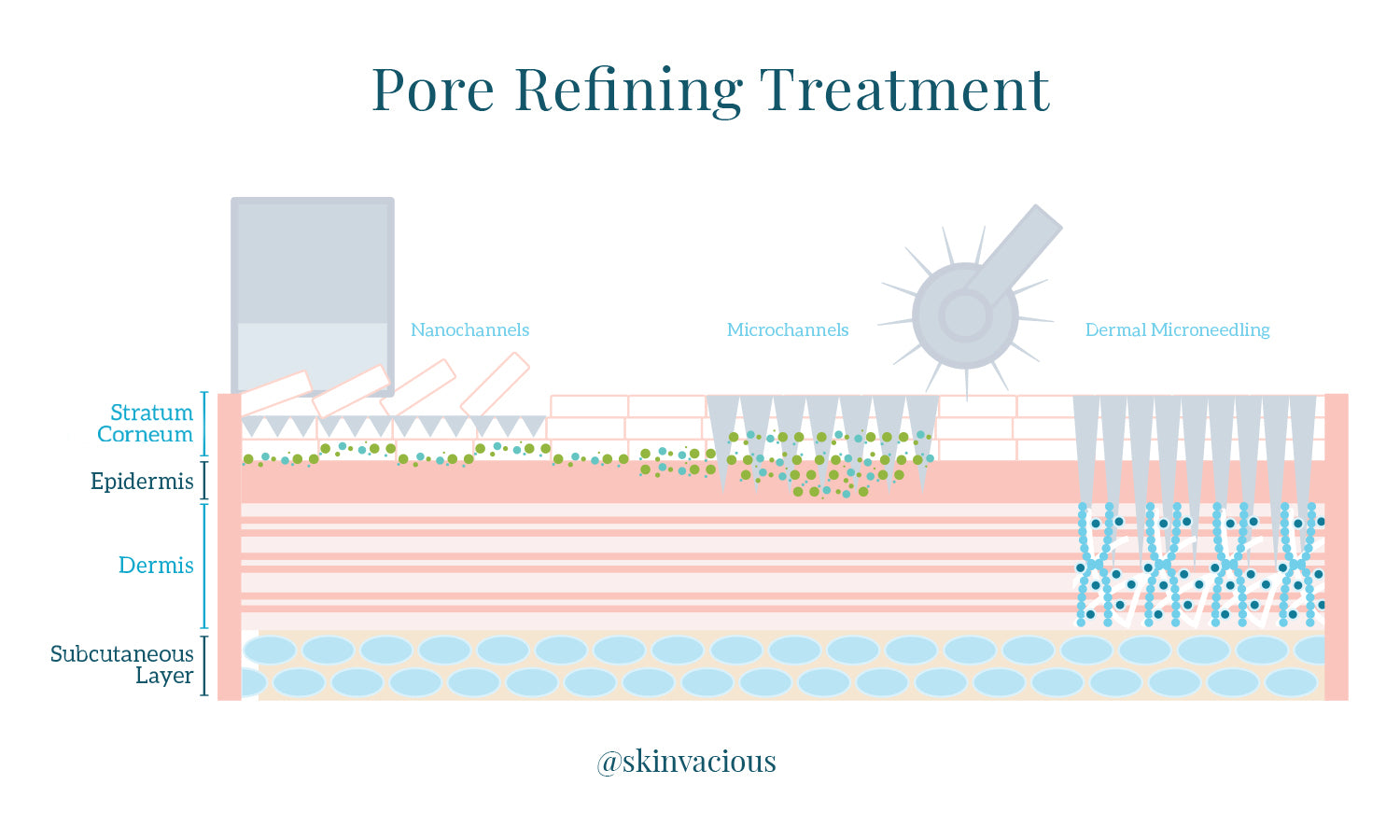3 Pore Refining Treatments - SKINVACIOUS SKIN TOOLS Microneedling Nano Pen