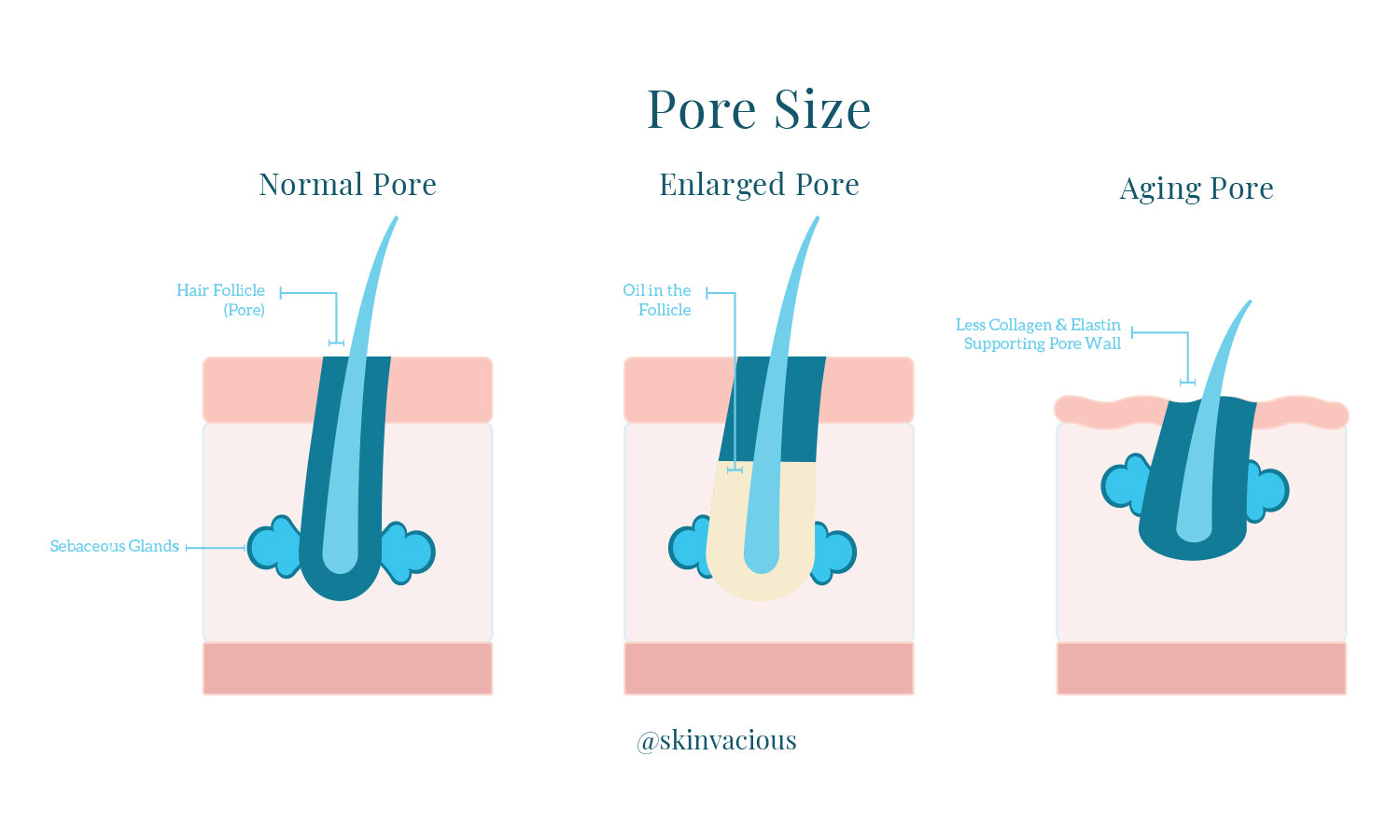 Pore SIze, Enlarged Pores, Aging Pores - SKINVACIOUS SKINCARE