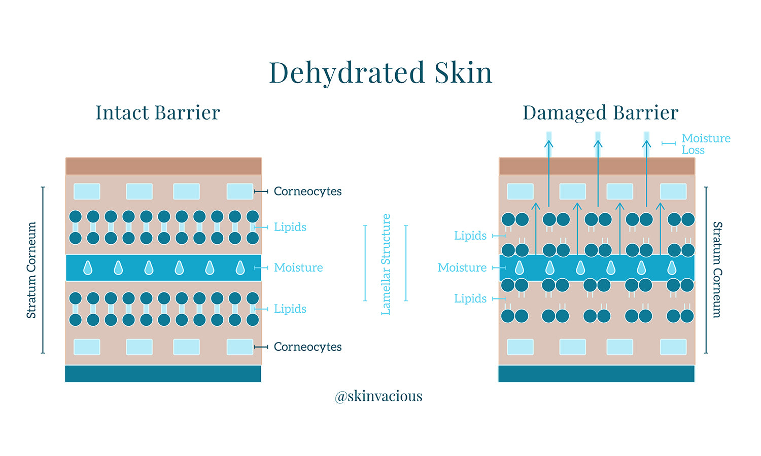skinVacious - Dehydrated Skin Barrier Defense