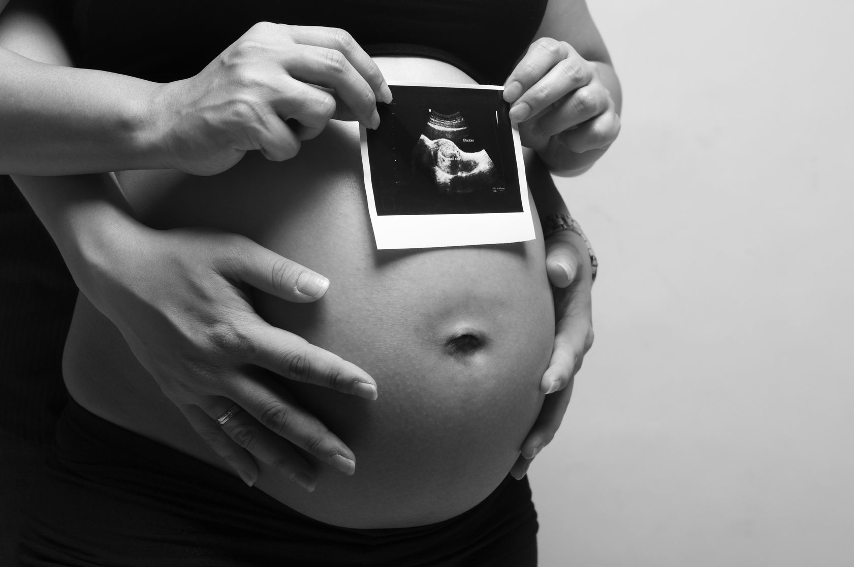 Беременность. Беременные женщины. Фотосессия беременной с УЗИ. Беременность картинки.